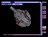 startrekst21766.jpg