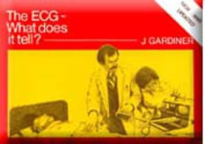 The ECG - what does it tell? - J Gardiner - Paperback - Used